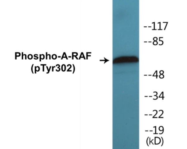 A-RAF (phospho Tyr302) Cell Based ELISA Kit (A102177-296)