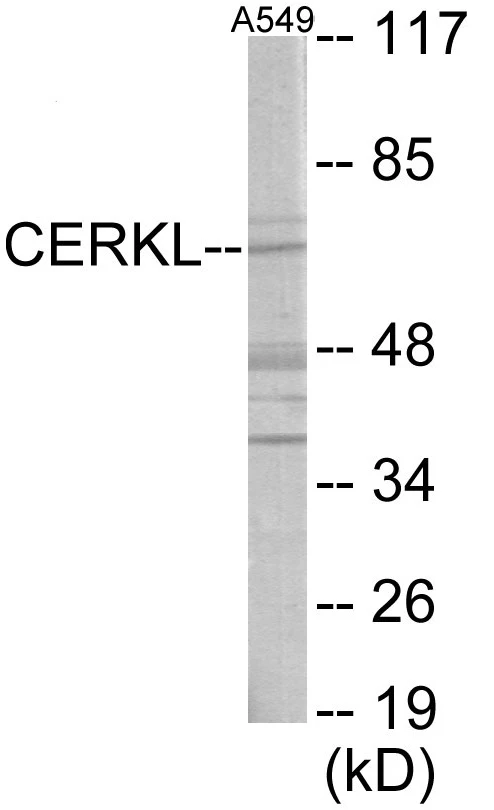 CERKL Cell Based ELISA Kit (A103673-96)