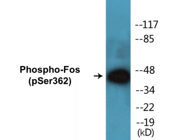 Fos (phospho Ser362) Cell Based ELISA Kit (A103829-296)