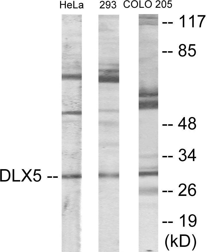 DLX5 Cell Based ELISA Kit (A103206-96)