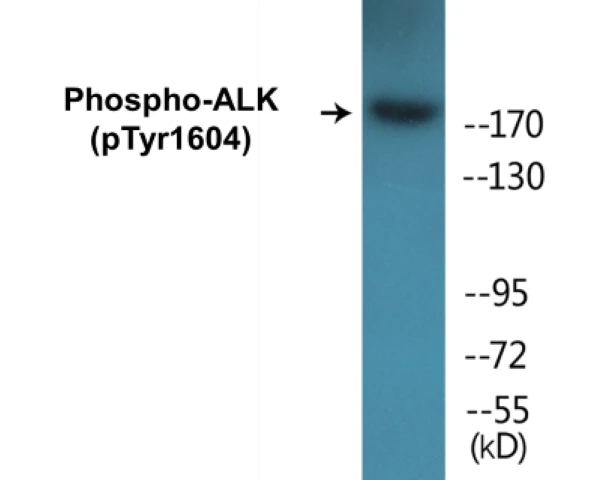 ALK (phospho Tyr1604) Cell Based ELISA Kit (A102733-296)