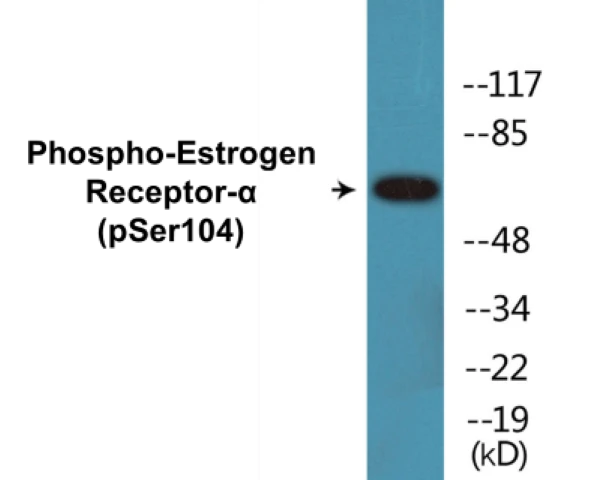 Estrogen Receptor alpha (phospho Ser104) Cell Based ELISA Kit (A102112-296)