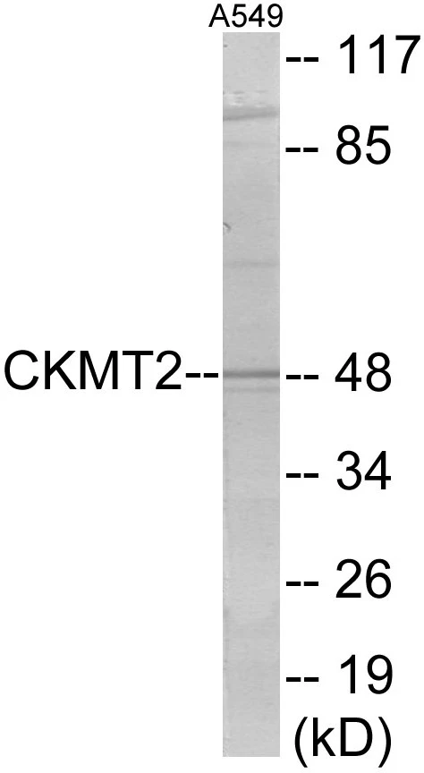 CKMT2 Cell Based ELISA Kit (A103139-96)