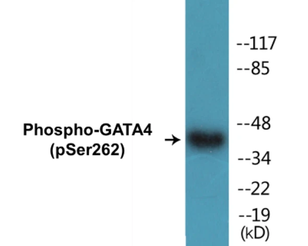 GATA4 (phospho Ser262) Cell Based ELISA Kit (A102183-296)