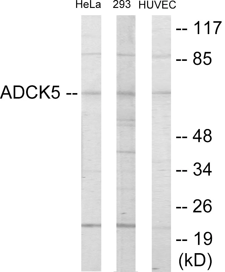 ADCK5 Cell Based ELISA Kit (A103699-96)