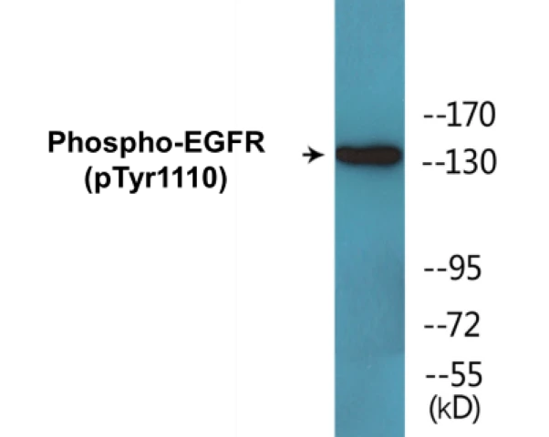 EGFR (phospho Tyr1110) Cell Based ELISA Kit (A102198-296)