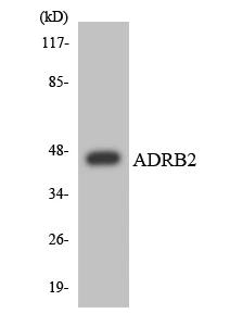 ADRB2 Cell Based ELISA Kit (A103175-96)