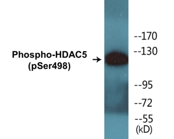 HDAC5 (phospho Ser498) Cell Based ELISA Kit (A102630-296)