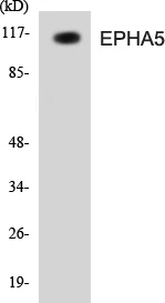 EPHA5 Cell Based ELISA Kit (A103088-96)