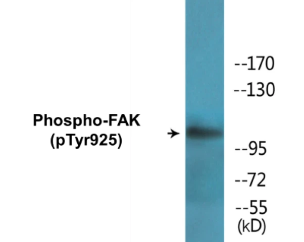 FAK (phospho Tyr925) Cell Based ELISA Kit (A102440-296)