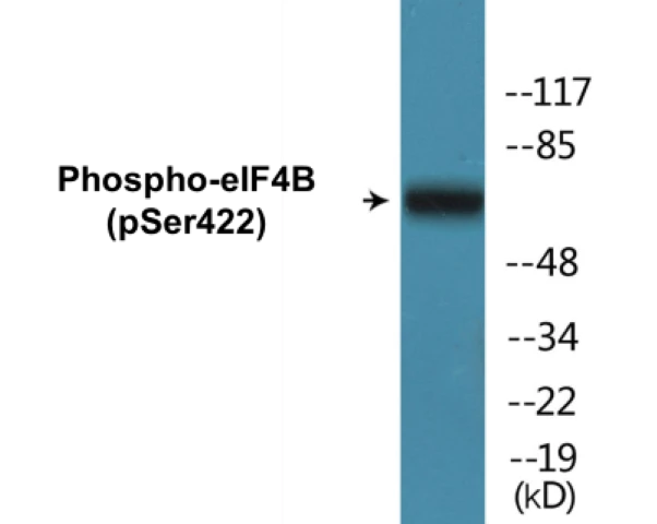 eIF4B (phospho Ser422) Cell Based ELISA Kit (A102619-296)