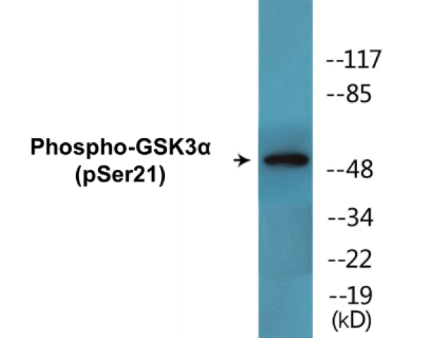 GSK3 alpha (phospho Ser21) Cell Based ELISA Kit (A102551-296)