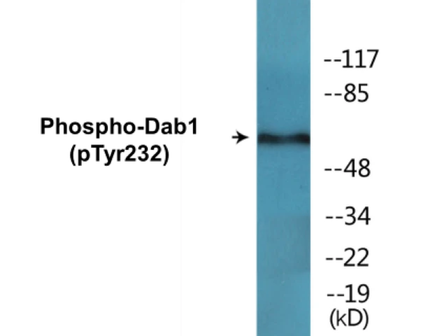 Dab1 (phospho Tyr232) Cell Based ELISA Kit (A102330-296)