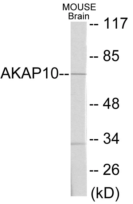 AKAP10 Cell Based ELISA Kit (A103017-96)