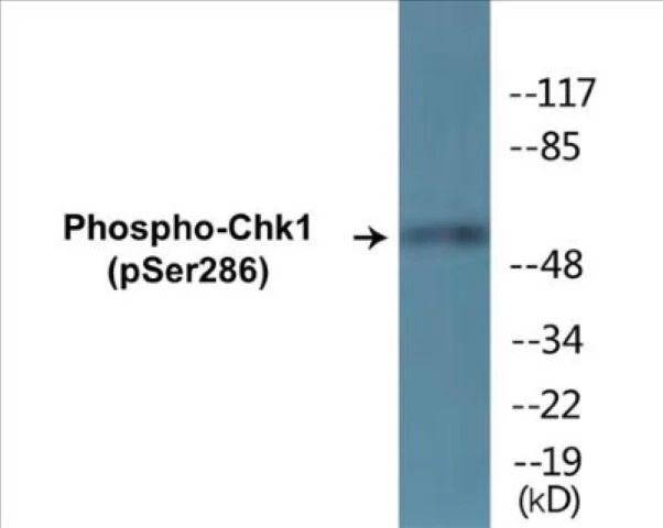 Chk1 (phospho Ser286) Cell Based ELISA Kit (A102736-296)