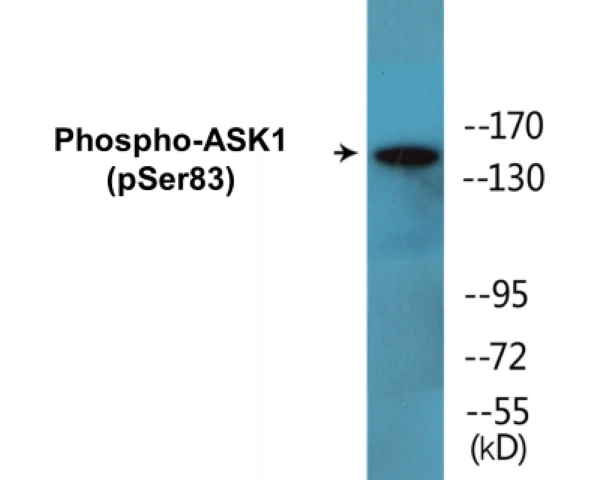 ASK1 (phospho Ser83) Cell Based ELISA Kit (A102753-296)