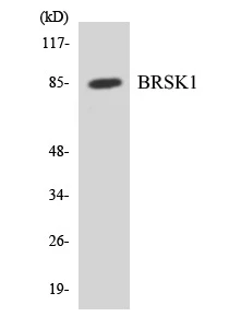 BRSK1 Cell Based ELISA Kit (A103487-96)