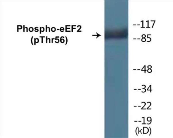 eEF2 (phospho Thr56) Cell Based ELISA Kit (A102389-296)