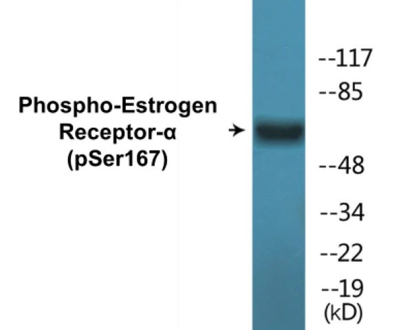 Estrogen Receptor alpha (phospho Ser167) Cell Based ELISA Kit (A102716-296)