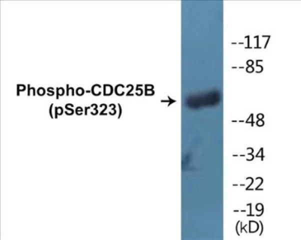 CDC25B (phospho Ser323) Cell Based ELISA Kit (A102080-296)