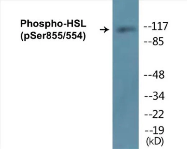 HSL (phospho Ser855 + Ser554) Cell Based ELISA Kit (A102487-296)