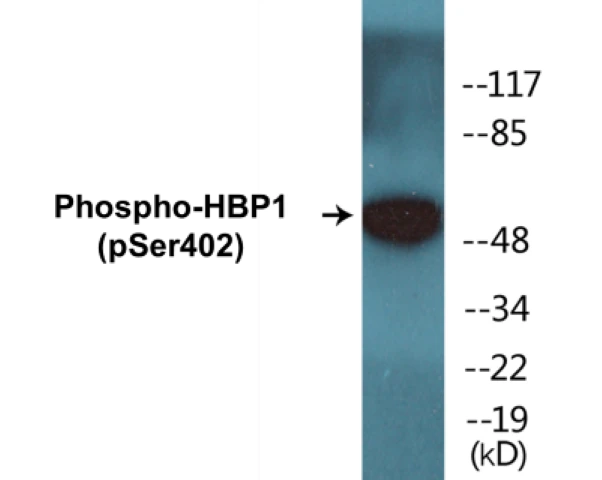 HBP1 (phospho Ser402) Cell Based ELISA Kit (A102738-296)