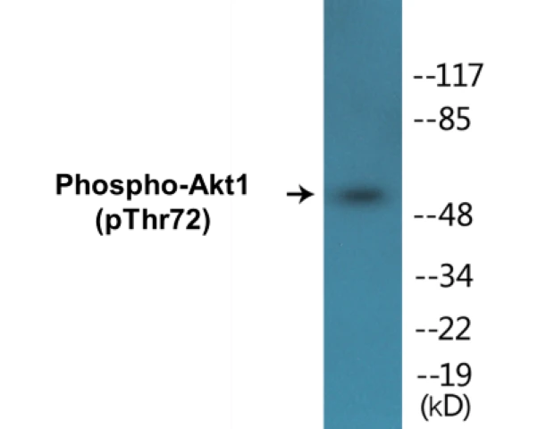 Akt1 (phospho Thr72) Cell Based ELISA Kit (A102425-296)