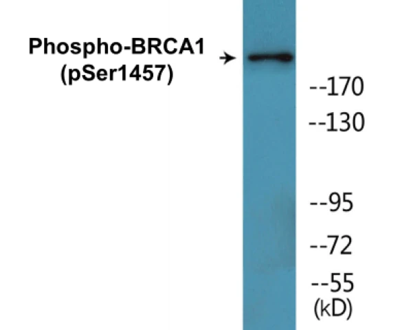 BRCA1 (phospho Ser1457) Cell Based ELISA Kit (A102713-296)