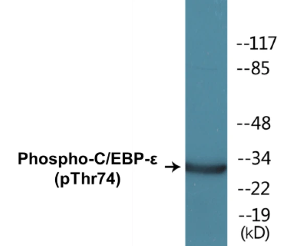 CEBP epilison (phospho Thr74) Cell Based ELISA Kit (A102766-296)