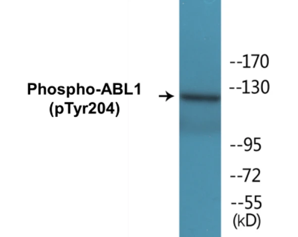 ABL1 (phospho Tyr204) Cell Based ELISA Kit (A102290-296)