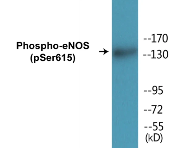 eNOS (phospho Ser615) Cell Based ELISA Kit (A102318-296)