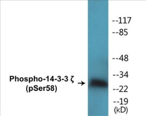 14-3-3 zeta (phospho Ser58) Cell Based ELISA Kit (A102511-296)