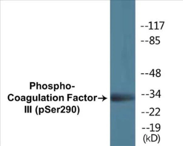 Coagulation Factor III (phospho Ser290) Cell Based ELISA Kit (A102727-296)