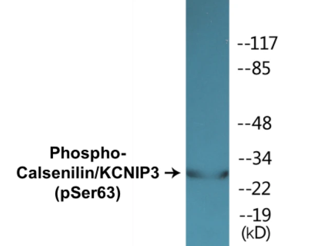 Calsenilin (phospho Ser63) Cell Based ELISA Kit (A102687-296)