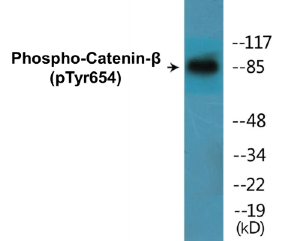 beta Catenin (phospho Tyr654) Cell Based ELISA Kit (A102492-296)