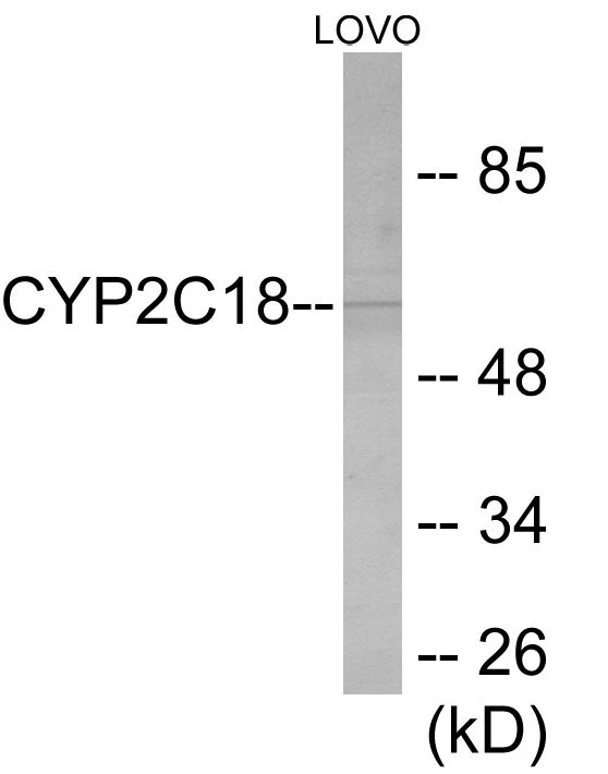 Cytochrome P45 02C8 + 9 + 18 + 19 Cell Based ELISA Kit (A103590-96)