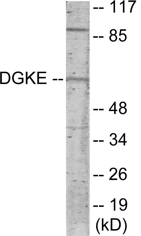 DGKE Cell Based ELISA Kit (A103286-96)