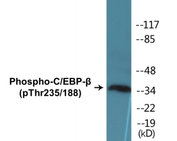 CEBP beta (phospho Thr235 + Thr188) Cell Based ELISA Kit (A102041-296)