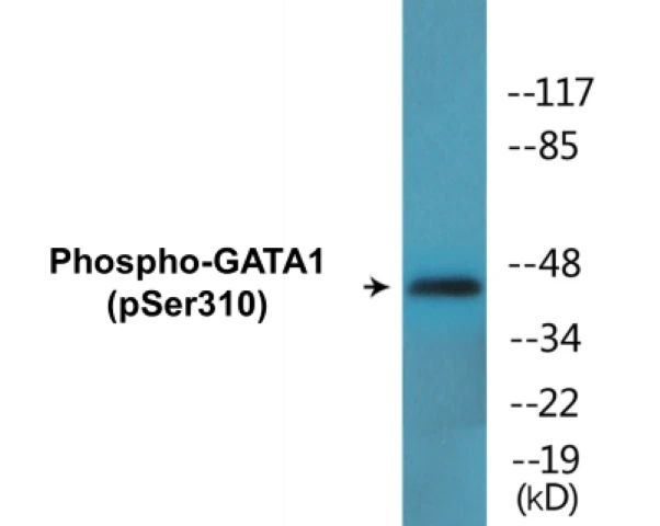 GATA1 (phospho Ser310) Cell Based ELISA Kit (A102201-296)