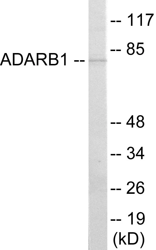 ADARB1 Cell Based ELISA Kit (A103025-96)