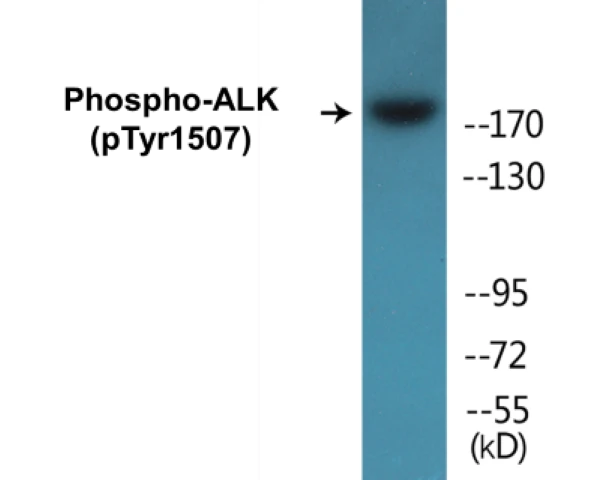 ALK (phospho Tyr1507) Cell Based ELISA Kit (A102647-296)