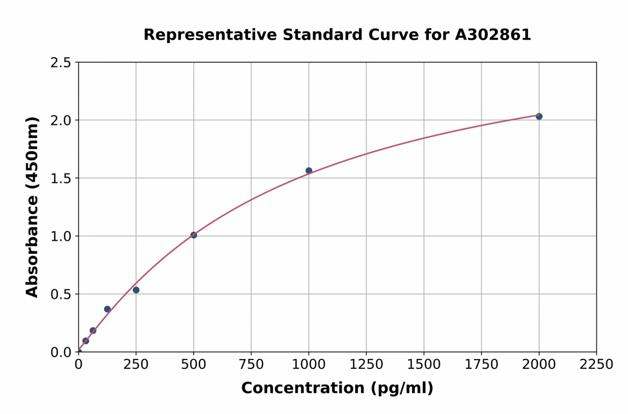 Human CMKLR1 ELISA Kit (A302861-96)