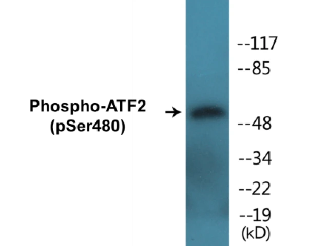 ATF2 (phospho Ser480) Cell Based ELISA Kit (A102698-296)