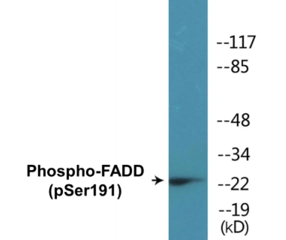 FADD (phospho Ser191) Cell Based ELISA Kit (A102790-296)