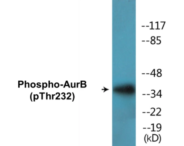 AurB (phospho Thr232) Cell Based ELISA Kit (A102278-296)