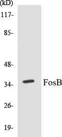 FosB Cell Based ELISA Kit (A103495-96)