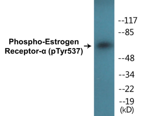 Estrogen Receptor alpha (phospho Tyr537) Cell Based ELISA Kit (A102603-296)