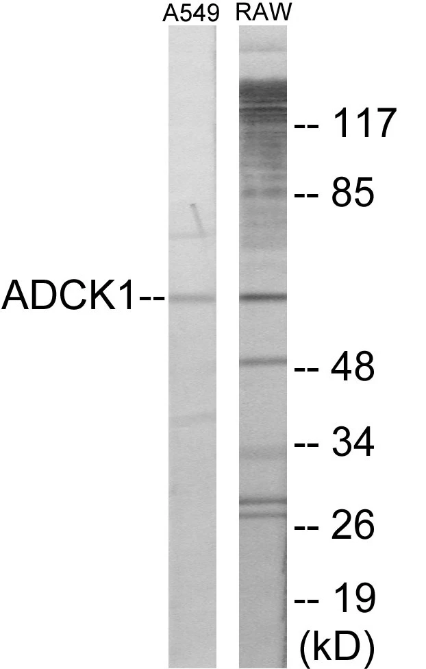 ADCK1 Cell Based ELISA Kit (A103483-96)