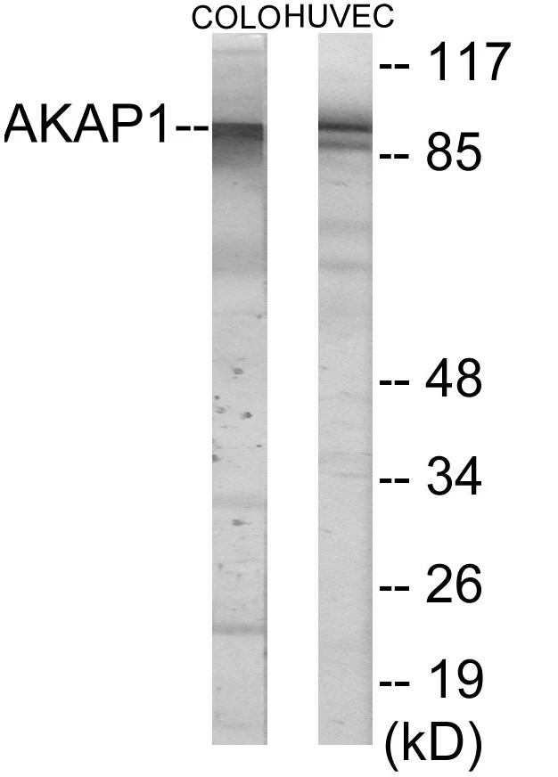 AKAP1 Cell Based ELISA Kit (A103707-96)