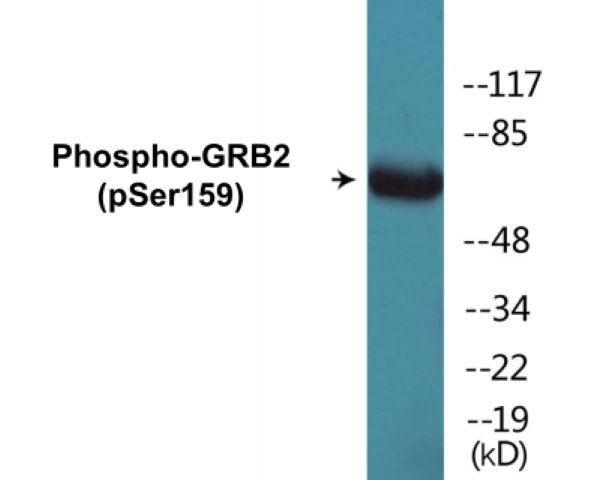 GRB2 (phospho Ser159) Cell Based ELISA Kit (A102268-296)